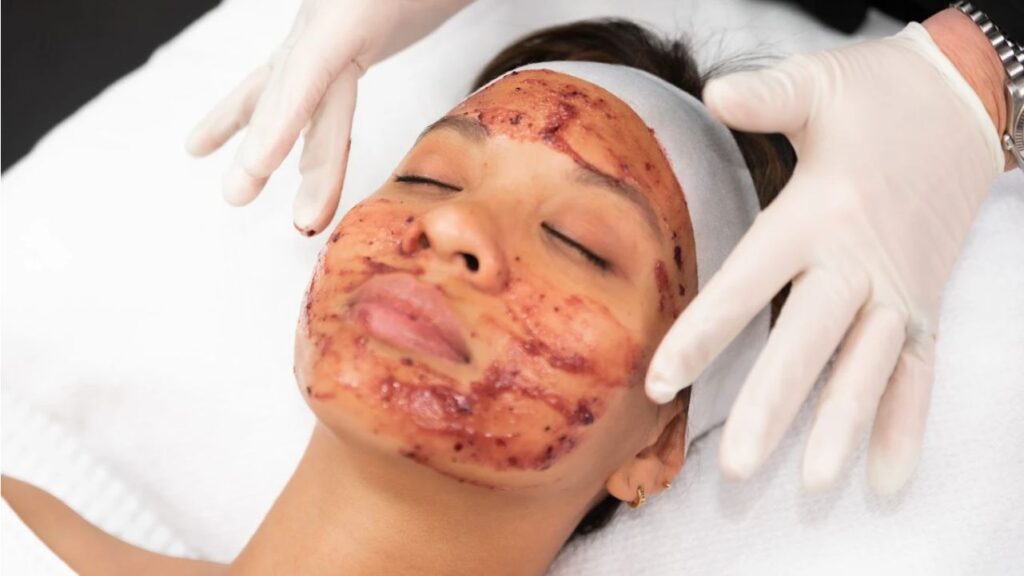 chemical peels in new south wales, the clinic bondi – medically-powered active peels