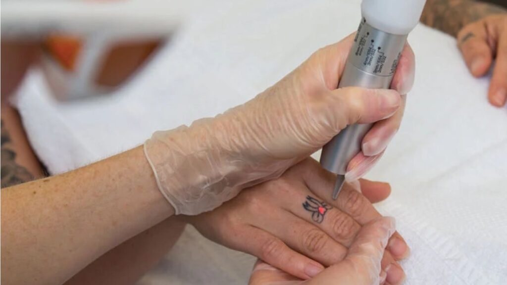 chemical peels in northern territory, territory laser clinic – aspect & cosmedix peels with minimal downtime